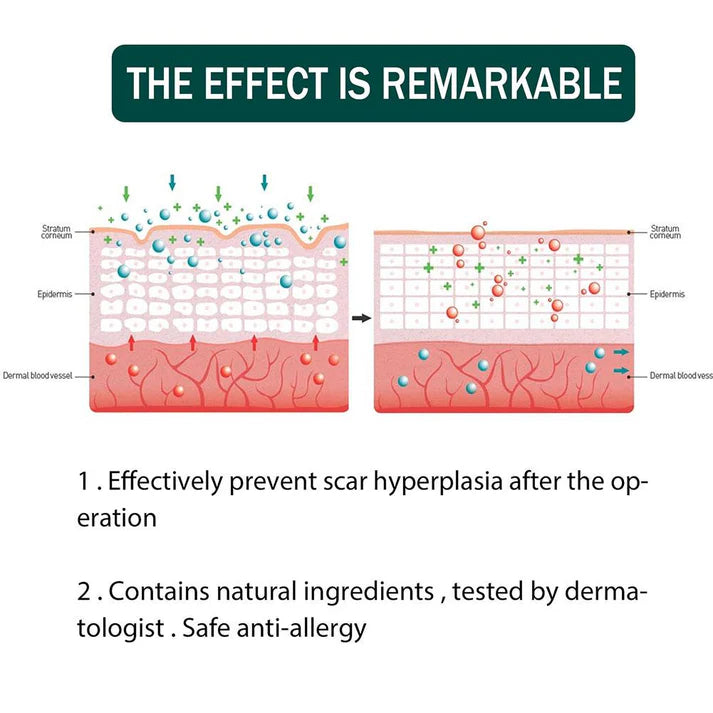 Chemical-Free Scar Remover Tape