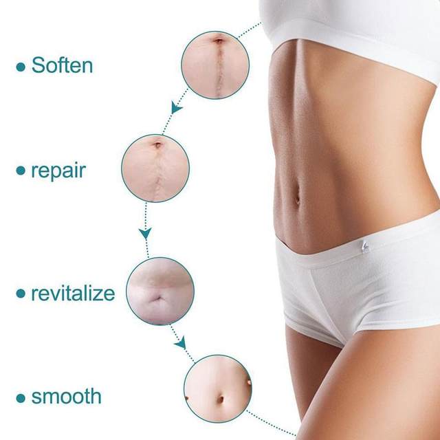 Chemical-Free Scar Remover Tape