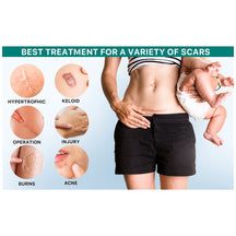 Chemical-Free Scar Remover Tape